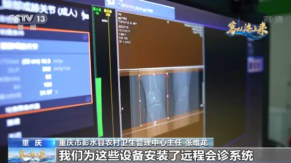 全球十大医疗器械企业集体亮相进博会 国际医疗产品加速落地开云 开云体育(图17)