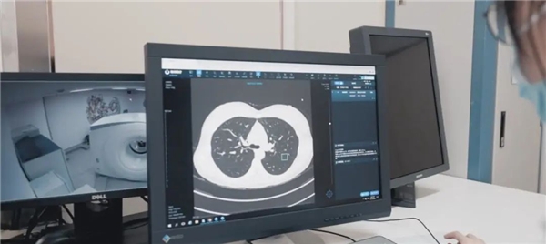 开云 开云体育推想多个AI解决方案落地重庆市妇幼保健院提质增效效果明显!(图3) 开云 开云体育推想多个AI解决方案落地重庆市妇幼保健院提质增效效果明显!(图3)