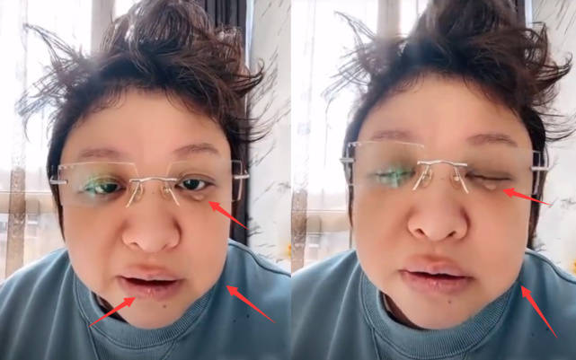 开云 开云体育官网韩红感染新冠仍坚持做公益捐赠600万购买呼吸机等医疗设备被赞正能量(图7) 开云 开云体育官网韩红感染新冠仍坚持做公益捐赠600万购买呼吸机等医疗设备被赞正能量(图7)