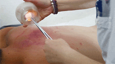 开云 开云体育年轻人都爱的“大保健”里面有啥猫腻？(图6)