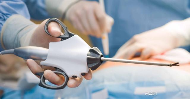 Kaiyun 开云体育中国95%的高端医疗设备 都依靠进口 为啥不用国产呢!(图8)