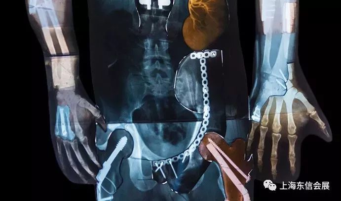 医疗器械开云体育 Kaiyun.com 官网入口主要领域发展现状分析(图4)