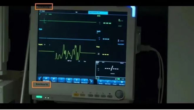 开云APP 开云官网入口3500万的仪器国产突破后仅卖293万？国产医疗器械的进阶之路(图2)