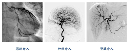首发丨专注介入诊疗影像设备唯迈医疗获高瓴1亿元C开云APP 开云官网入口+轮融资(图2)