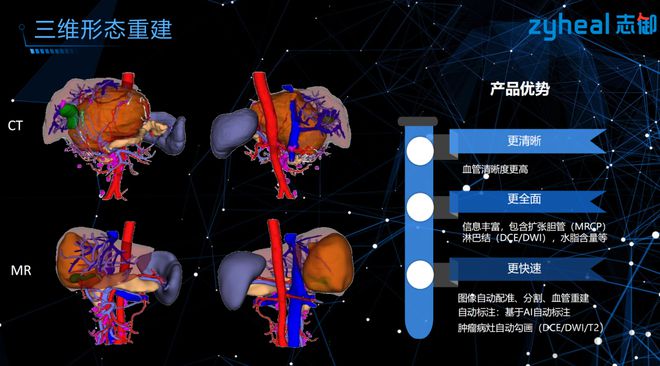 开云体育 开云官网【首发】肝脏影像AI企业获近千万加速推动旗下产品商业化进程(图3)