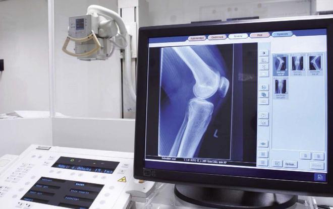 中国医疗设备95%依靠进口难道真的开云 开云体育官网造不出来?不怕被卡脖子吗?(图6) 中国医疗设备95%依靠进口难道真的开云 开云体育官网造不出来?不怕被卡脖子吗?(图6)