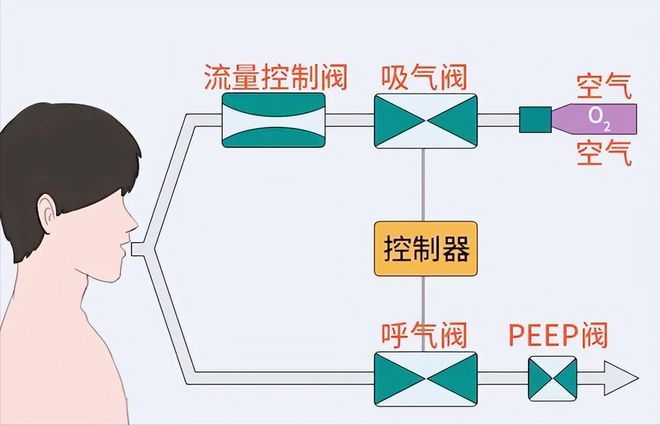 中国医疗设备95%依靠进口难道真的开云 开云体育官网造不出来?不怕被卡脖子吗?(图4) 中国医疗设备95%依靠进口难道真的开云 开云体育官网造不出来?不怕被卡脖子吗?(图4)