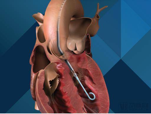 医疗器械行业分析：万亿开云体育 开云官网市场这些赛道潜力无限不容错过！(图21)