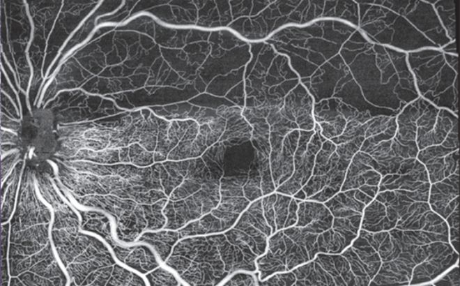 Kaiyun 开云图湃医疗获近15亿元A轮融资推进高端眼科医疗设备的自主创新(图2)
